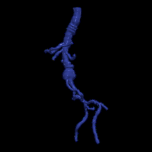3d modelo aorta femoral arterias 3d print model - Mito3D