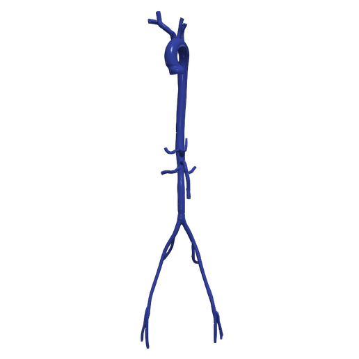 3d Modell Aorta femoral Arterien 3D print model - Mito3D