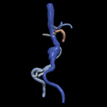 3d model aorta femoral arteries 3d print model - Mito3D