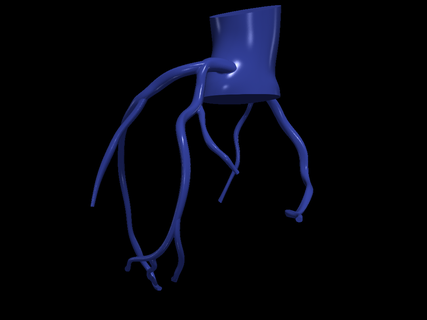 3d model koroner arterler kalp kardiyovasküler sistemi Odalar apikal görünüm kardiyoloji aort kemer arter 3d print model - Mito3D