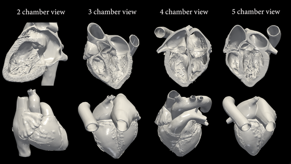 3d model heart 2345 chamber view - 4 pack cardiovascular cardiac system chambers apical cardiology 3d print model - Mito3D