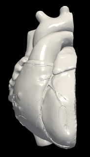 3d model heart apical 2 chamber plane Various cardiovascular cardiac system chambers of view cardiology 3d print model - Mito3D