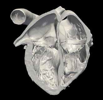 3d model heart apical 4 chamber plane Various cardiovascular cardiac system chambers of view cardiology 3d print model - Mito3D