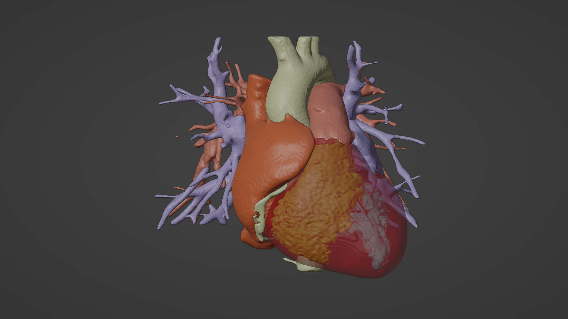 3d model heart real patient cardiovascular cardiac system chambers apical view cardiology 3D print model - Mito3D