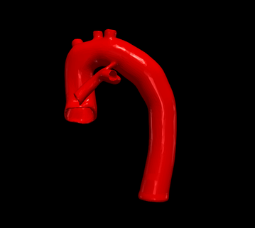 3d modello cuore tetralogia fallot freddo vari cardiovascolare cardiaco sistema camere apicale Visualizza cardiologia congenita patologia 3d print model - Mito3D