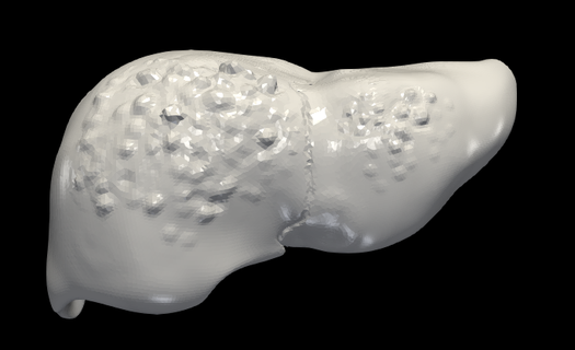 3d modèle foie hépatite foies mauvais santé anatomie Humain éducation médical médicament biologie 3d print model - Mito3D