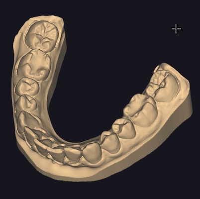 3d model of human jaw jaws teeth medicine 3d print model - Mito3D