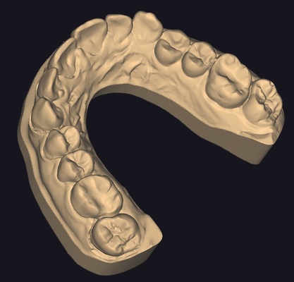 3d model of realistic human upper jaw jaws teeth medicine 3d print model - Mito3D