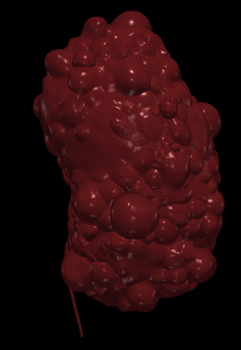 3d modelo policístico rim anatomia humano médico medicamento biologia órgãos órgão 3d print model - Mito3D