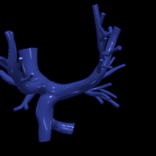 3d model pulmoner arterler Çeşme prosedür 3d print model - Mito3D