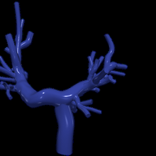 3d modèle pulmonaire artères Fontaine procédure 3d print model - Mito3D