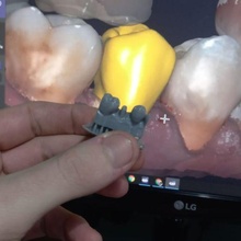 3d model teeth crown dental models 3d print model - Mito3D