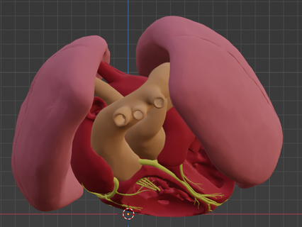 3d Modell Umsetzung großartig Arterien öffnen Leitung verschiedene Herz kardiovaskulär System Kammern apikal Aussicht Kardiologie Arterie angeboren Krankheit 3d print model - Mito3D