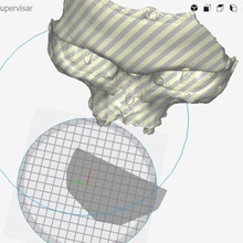 africano cranio vari la medicina 3d print model - Mito3D