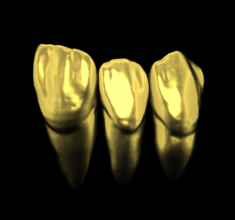 anatómico dental puente 3d print model - Mito3D