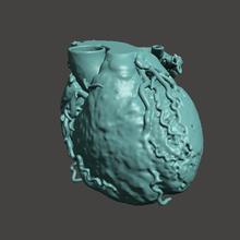 anatomik kalp 3d print model - Mito3D