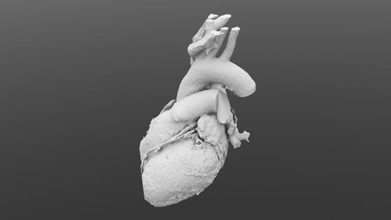 anatomical heart dicom anatomy cardiology images medical models 3d print tomography resonance magnetic pathology teaching surgery intervention planning simulation visualization 3d print model - Mito3D