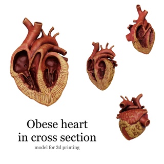 anatomical human obese heart cross section Various heart in cross section anatomy anatomical obese heart human obese  heart anatomical model  3d print model - Mito3D