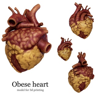 anatomical model obese heart Various anatomy human 3d print model - Mito3D