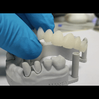 articulated model plus provisional bridge dental models resin prosthetic dentistry education research development prosthodontist 3d print model - Mito3D