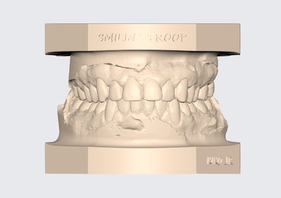 artikuliert oberer höher dental modell 4 orthopädietechniker techniker zahn 3d stl zahnarzt frei kieferorthopädie drucken 3d print model - Mito3D