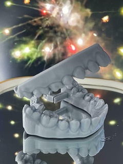 articulateur impression modèle prêt printabledentalarticulator dentaire 3dprint 3d print model - Mito3D
