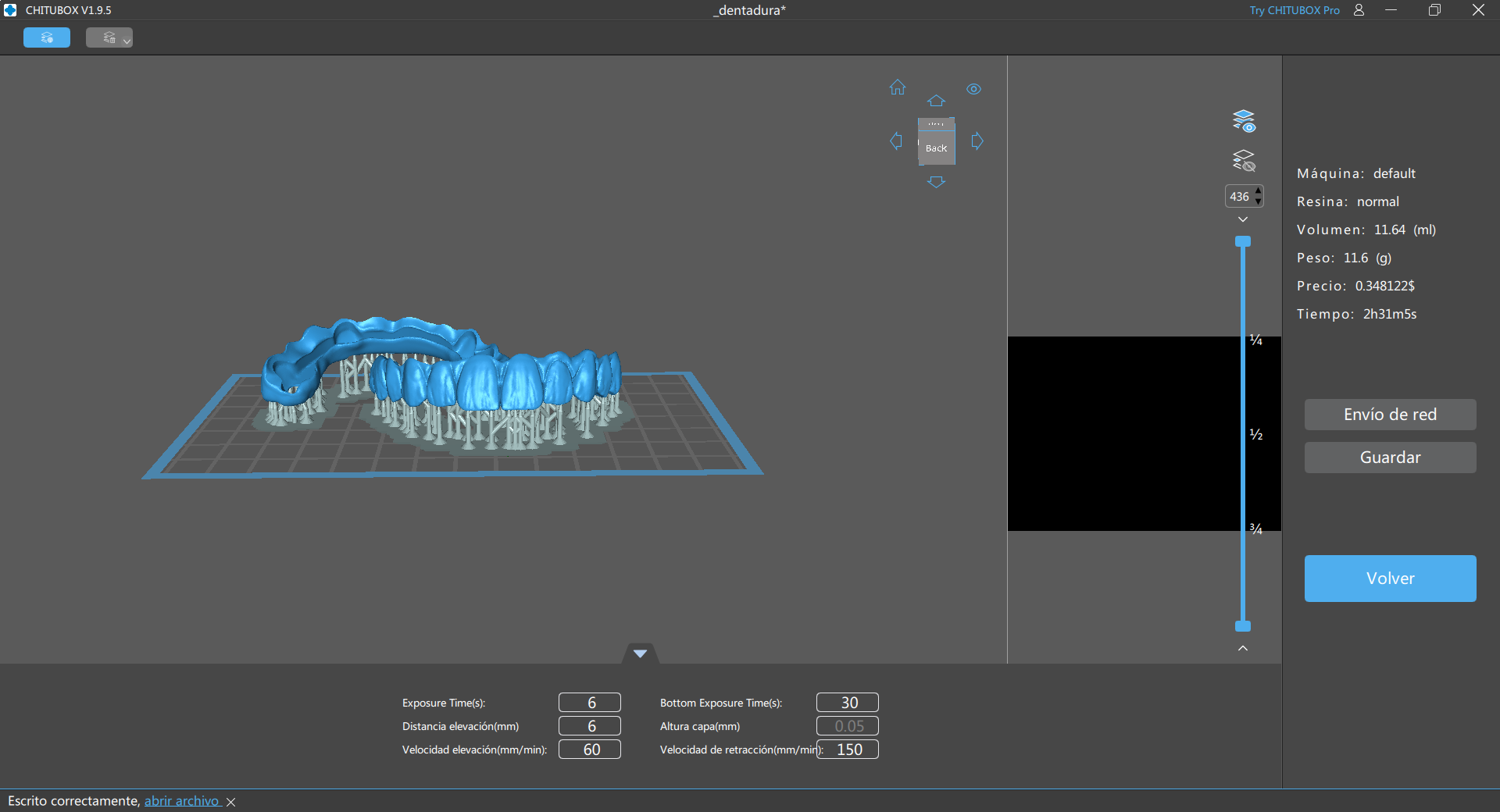 bar overdenture models 3D print model - Mito3D