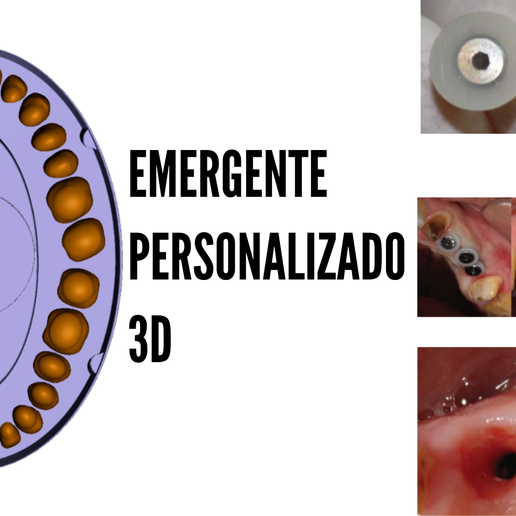 base di generare emergenza profilo-cicatrice spine strumento dental l'odontoiatria il dentista tessuto cicatriziale profilo cicatrice 3D print model - Mito3D