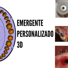 base generate emergency profile-scar plugs tool dental dentistry dentist scar tissue emergence profile 3d print model - Mito3D