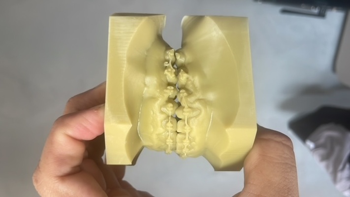base pára modelos ortodontia medidas borda odontologia modelo ortodôntico documentação 3d print model - Mito3D