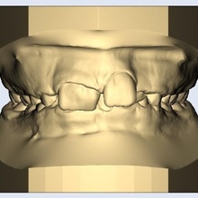 grande centrale denti dentale fusione Modelli dentista simpatico modello arco arcade 3d print model - Mito3D