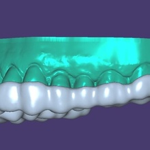 mordere Splint + modello riposo piatto denti 3d print model - Mito3D