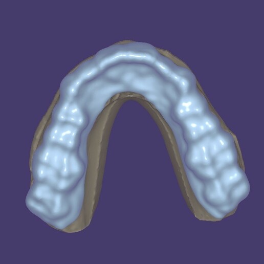 mordre éclisse + modèle repos assiette dentaire 3D print model - Mito3D