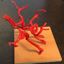 brain arteries various 3d print model - Mito3D
