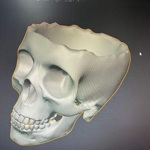 broken skull-vase 3d print model - Mito3D