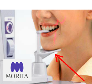 cbct chin guard - morita dental dentistry teeth mouth design 3d print model - Mito3D