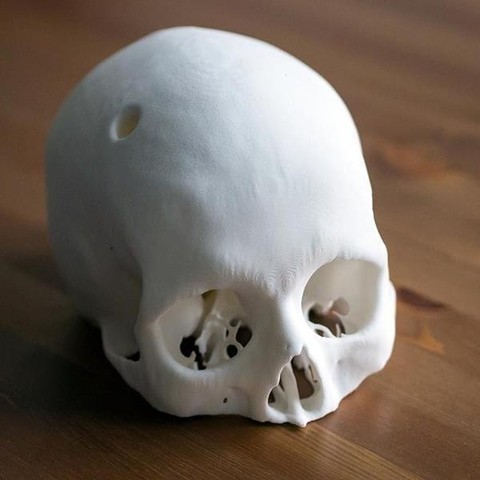 cerebrix di un cranio umano vari 3D print model - Mito3D