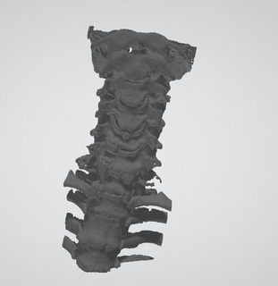 cervical limitar canal ortopedia traumatologia coluna ligamento costas calcificação ciência 3d print model - Mito3D
