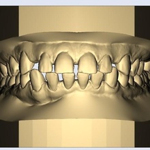 combo modèles spécial prix dentaire dents dentiste agréable modèle cambre arcade 3d print model - Mito3D