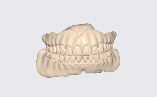Achevée dentier dents prothèse numérique entreprise terminée completedenturewithdentureteeth dentisterie 3d print model - Mito3D