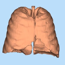 covid-19 lungs covid 19 3d print model - Mito3D