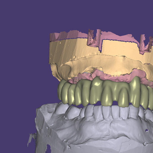 diş kemer cad cam Sanat 3D print model - Mito3D