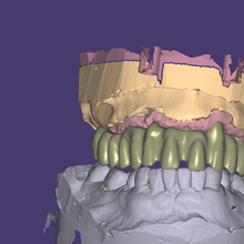 dentale arco cad cam arte 3d print model - Mito3D