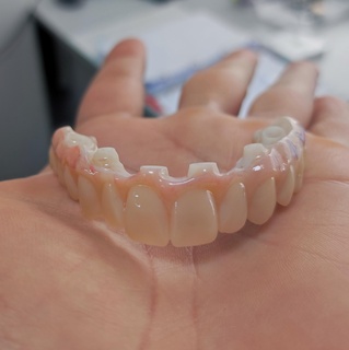 dental arch dentistry arcade teeth model orthodontics dentist tooth molar 3d print model - Mito3D