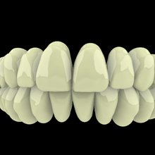 dental librería diente dientes galería odontología 3d print model - Mito3D
