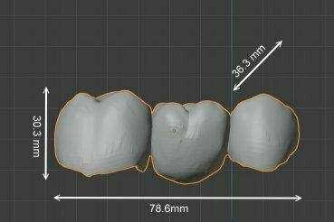 dental puente 3 coronas modelo corona rehabilitación comercial márketing 3d print model - Mito3D