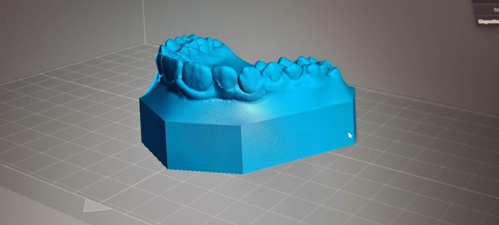 diş tam kemer çeşitli model 3d print model - Mito3D