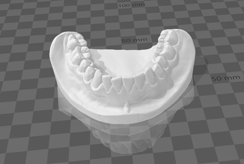 dental impression tooth art realistic teeth 3d print model - Mito3D