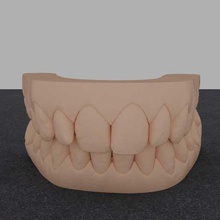 dental modelo resina mordida dente dentes boca 3d print model - Mito3D