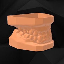 dental modelo herramienta ortodoncia 3dprint grave abrasión 3dmodel dentista odontología dentadura humano dientes diente mandíbula 3d print model - Mito3D